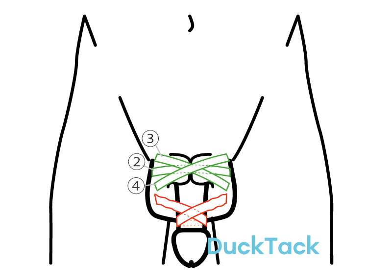 股間タック　クリタックペニスの根元にクリトリス固定用のテープを貼り土台を作る説明イラスト